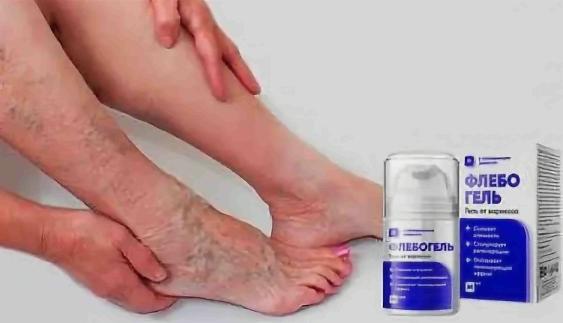 Эффективные лечебные гели для ног от варикоза